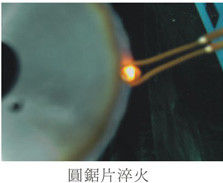 Equipo de fusión por inducción de ultraalta frecuencia de 1-2 MHz